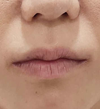 전