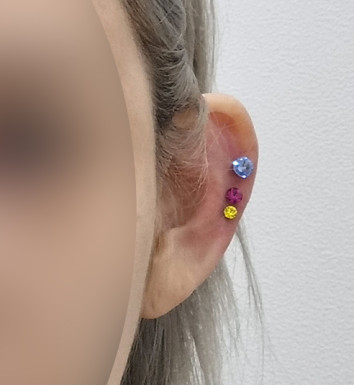 후