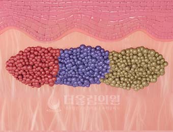 STEP 01. 피부 타입과 색소 깊이 분석