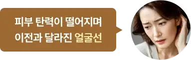 피부 탄력이 떨어지며 예전과 달라진 얼굴선