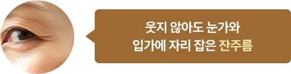 웃지 않아도 눈가와 입가에 자리 잡은 잔주름
